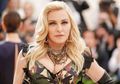 Ajaib! Cuma Pakai Garpu, Kulit Madonna Jadi Kencang dan Sehat, Gimana Caranya?