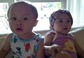 Ikan Teri Jadi Menu Andalan Cynthia Lamusu, Ini Khasiatnya untuk Anak!