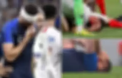 Ngeri! Kepala Giroud Bocor ketika Prancis Bertanding Melawan USA