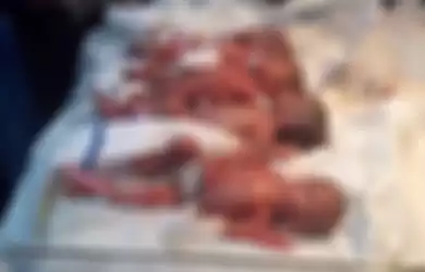 Seorang perempuan di Irak melahirkan tujuh bayi kembar (septuplet) dalam satu persalinan. Semuanya selamat.