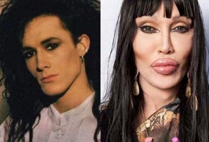 Pete Burns