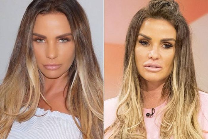 Katie Price