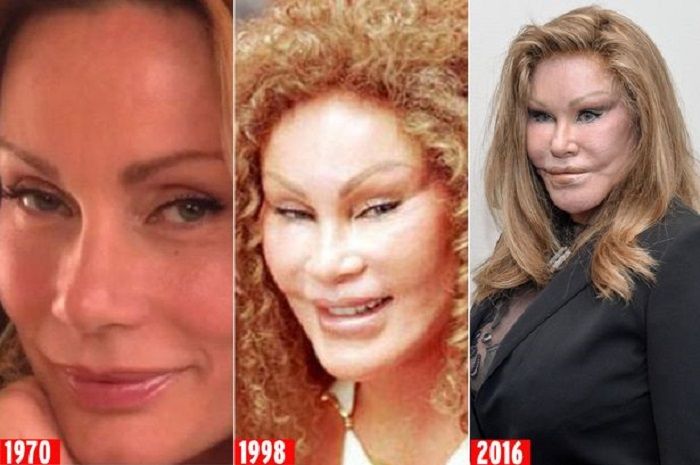 Jocelyn Wildenstein
