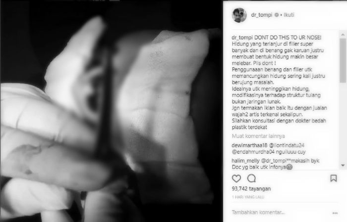 Postingan Tompi