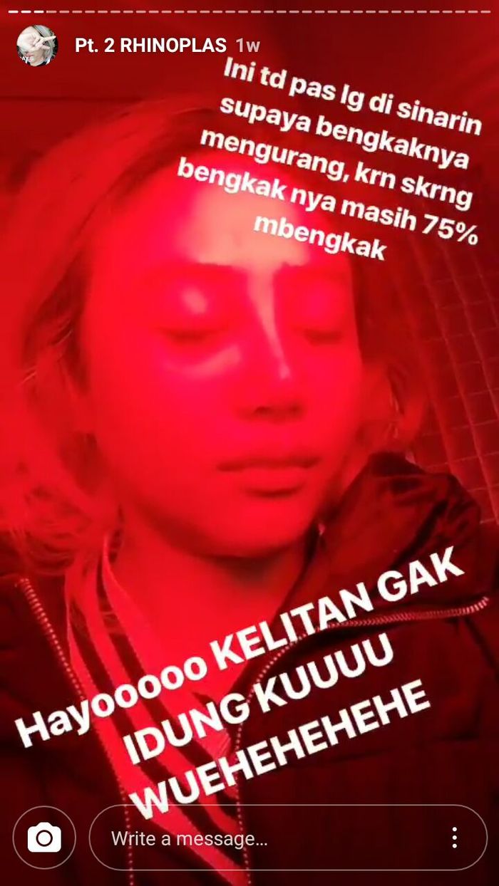 Proses Melepas Perban dan Penyinaran