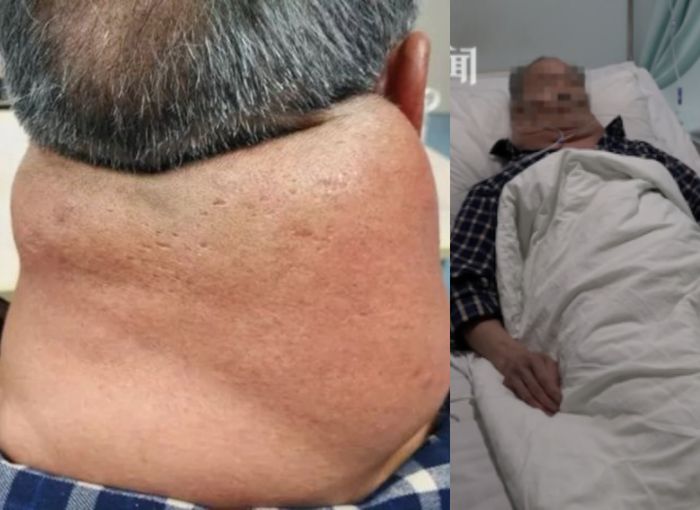 Tan sempat dirawat di rumah sakit