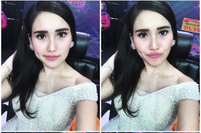 Ayu Ting Ting
