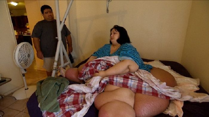 Mayra sebelum operasi sedot lemak