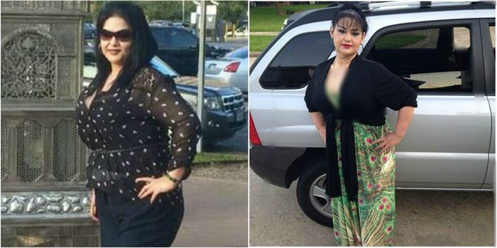 Mayra Rosales setelah operasi sedot lemak dan diet ketat