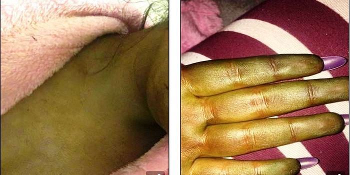 Lulur palsu membuat kulit Danni jadi berwarna hijau