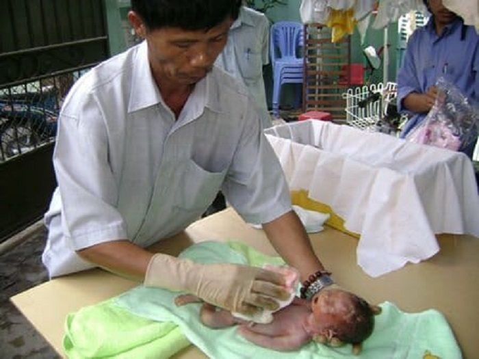 Tong dan bayi di tangannya