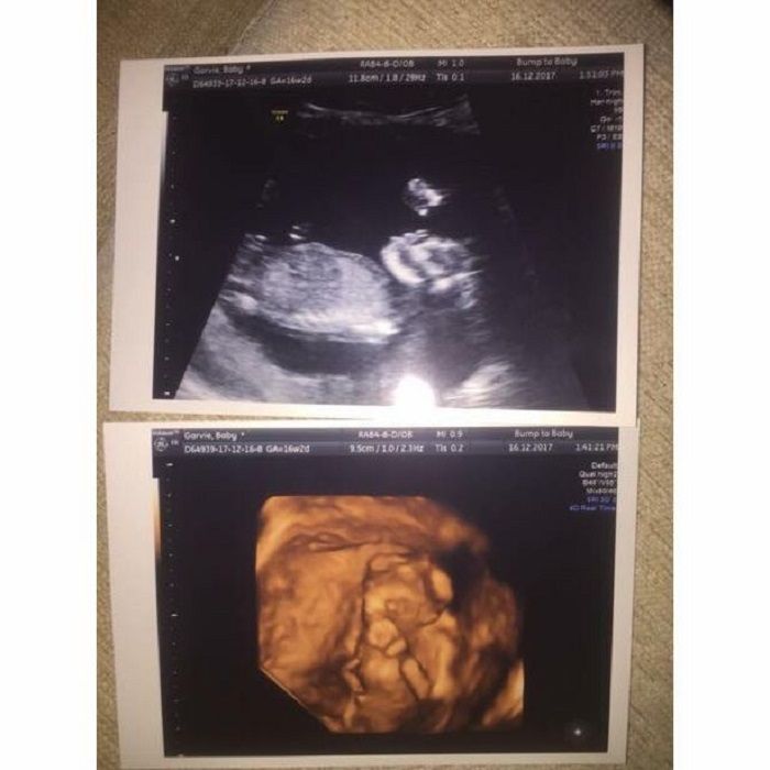 USG bayi