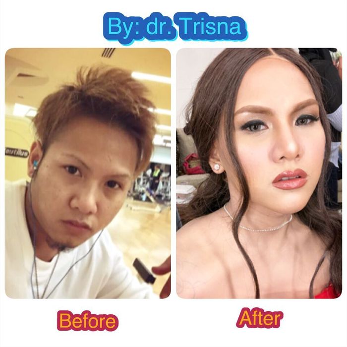 Foto Before-after