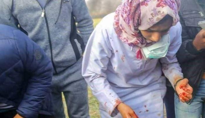 Penampilan Razan usai menangani korban