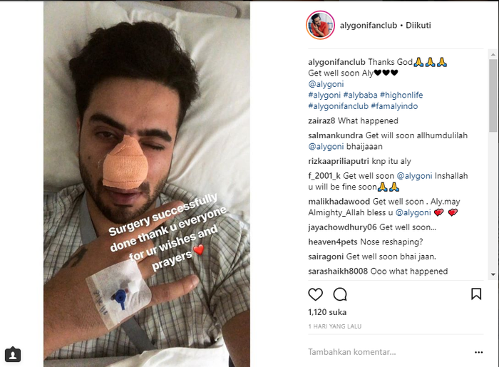 Aly Goni lakukan operasi hidung