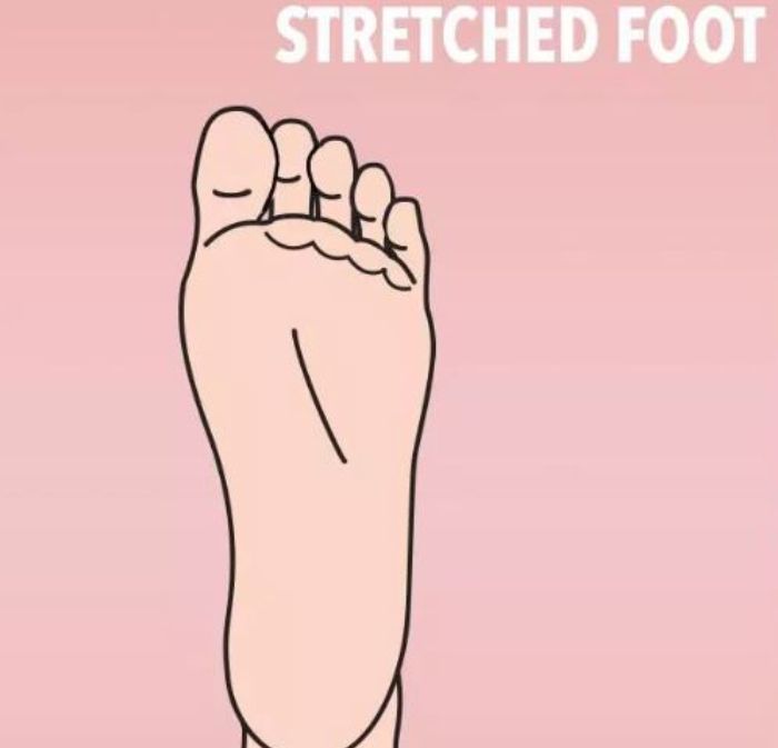 Stretched Foot