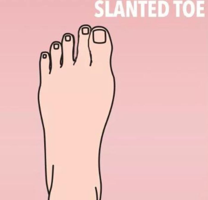 Slanted Toe