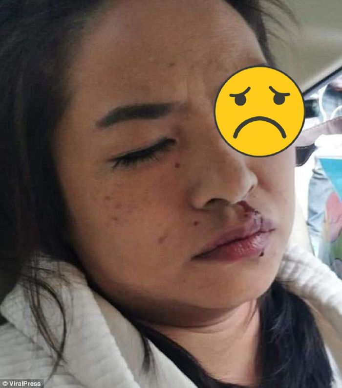 matanya tertusuk
