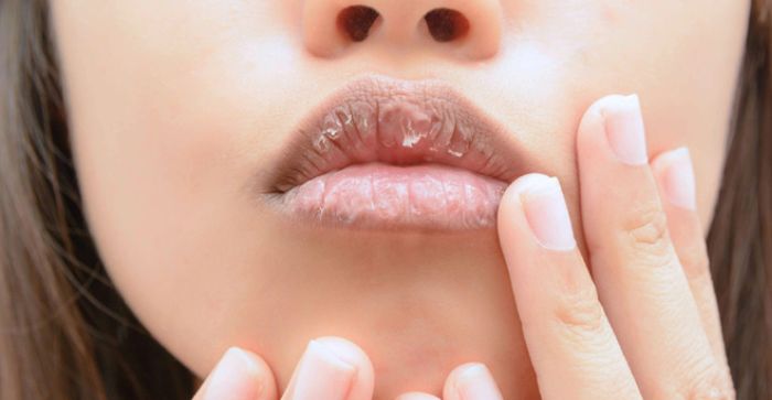 Atasi bibir kering dengan deretan lip balm ini yuk!