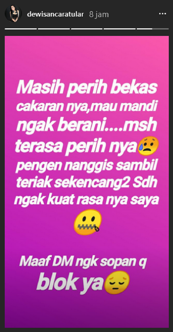 Dewi Sanca ngeluh tak berani mandi karena bekas cakarannya masih perih