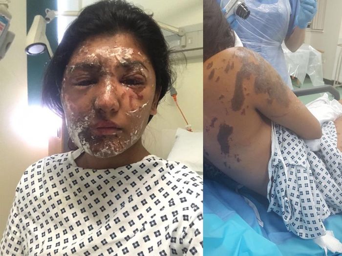 Luka yang menimpa seorang model