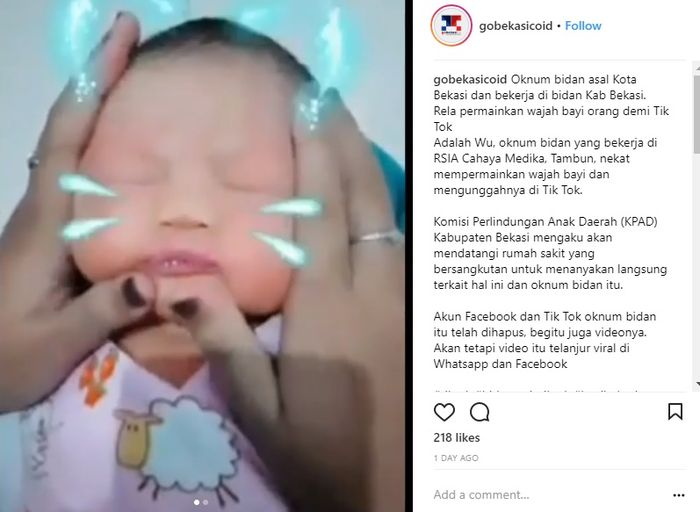 Bidan memainkan wajah bayi di Tik Tok