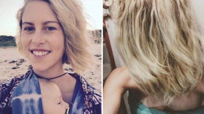 Kondisi Rambut Virginia Tapp
