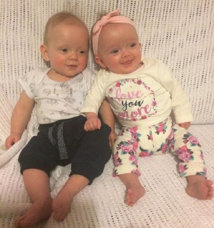 Potret Jakob dan Isla semakin sehat