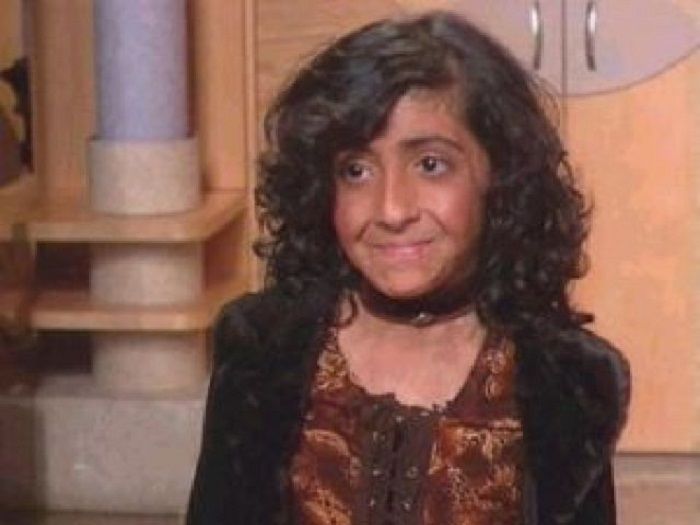 Wajah Zubaida saat ini