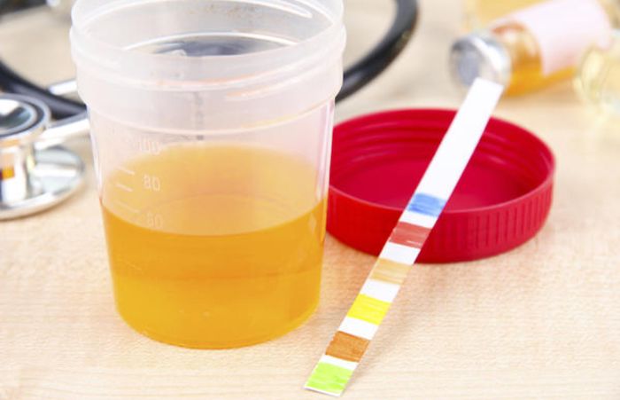 Beberapa penyebab urine memiliki aroma tak biasa