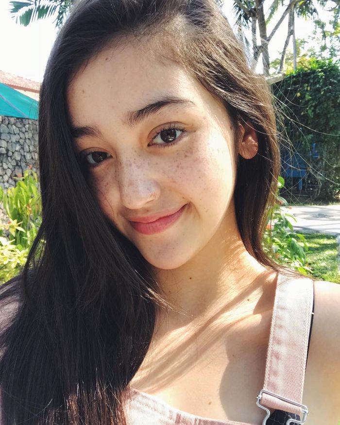 Freckles pada wajah Ranty Maria