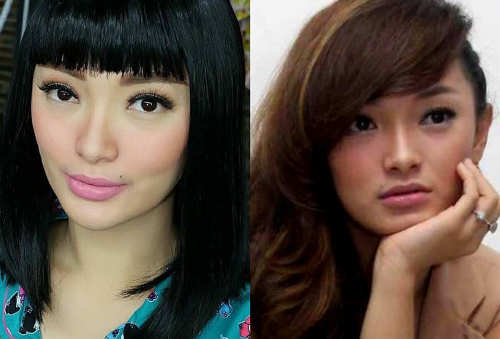 Bibir Zaskia Gotik sekarang dan dulu