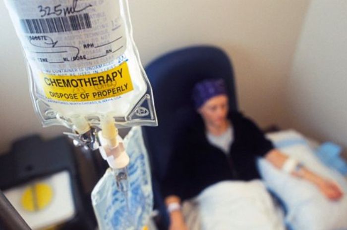 Kenali 6 Efek Samping yang Bisa Terjadi Akibat Lakukan Kemoterapi