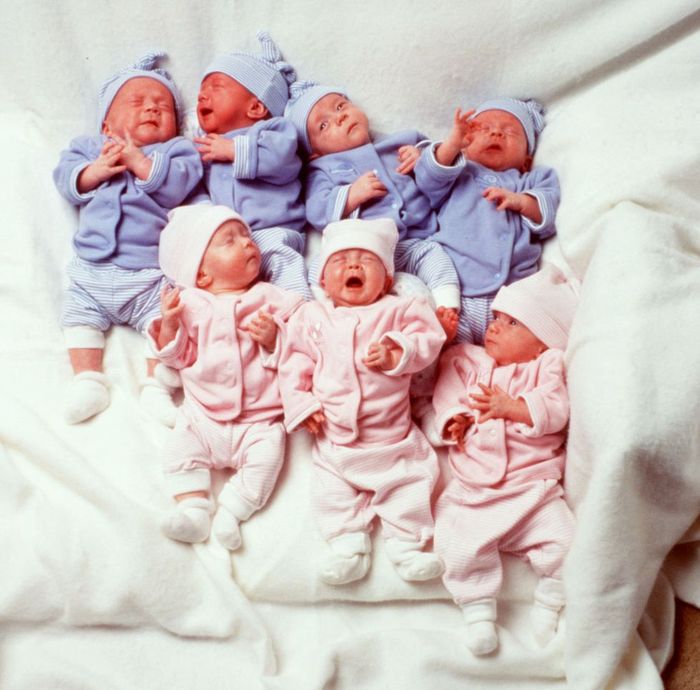 Bayi kembar 7