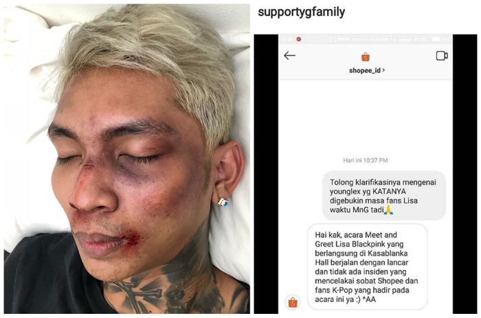 Unggahan Ypung Lex dan konfirmasi dari pihak Shopee
