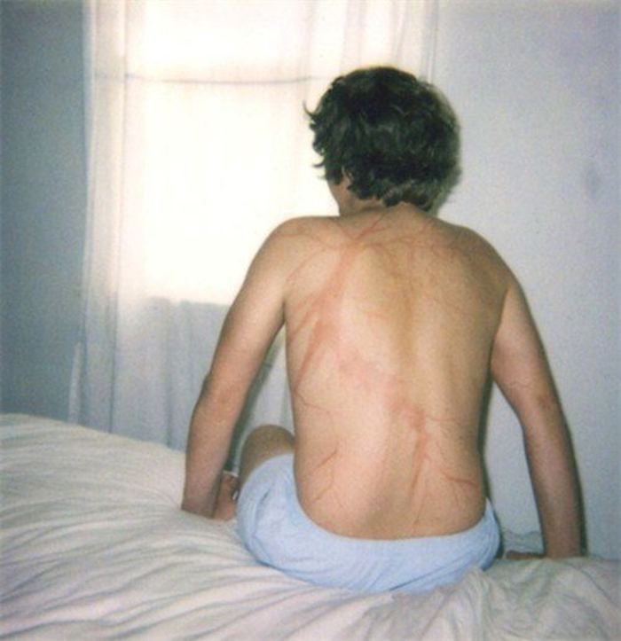 Contoh ‘Lichtenberg’.