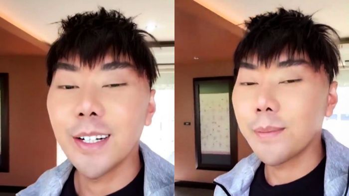 Penampilan b aru Roy Kiyoshi pasca melakukan operasi wajah.