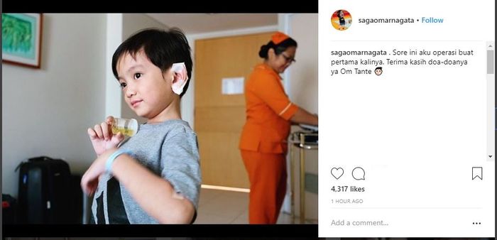 Saga Omar Nagata Akan Jalani Operasi Sore Ini
