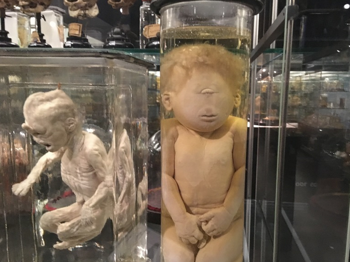Bayi bermata satu, salah satu koleksi museum