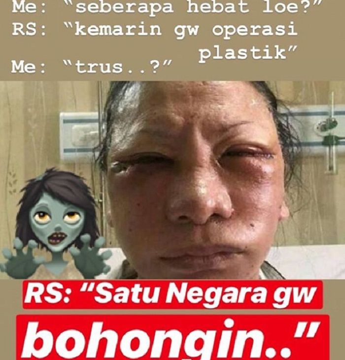 meme ratna sarumpaet
