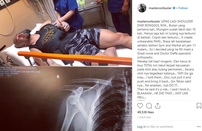 Deddy Corbuzier masuk rumah sakit