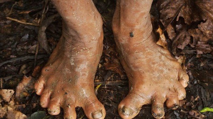 Struktur jari kaki Suku Huaorani yang berbeda dan unik