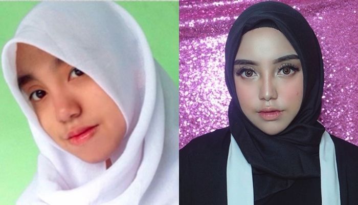 Ungkap Alasannya Lakukan Filler, Penampilan Baru Putri Sunan Kalijaga Bikin Pangling!