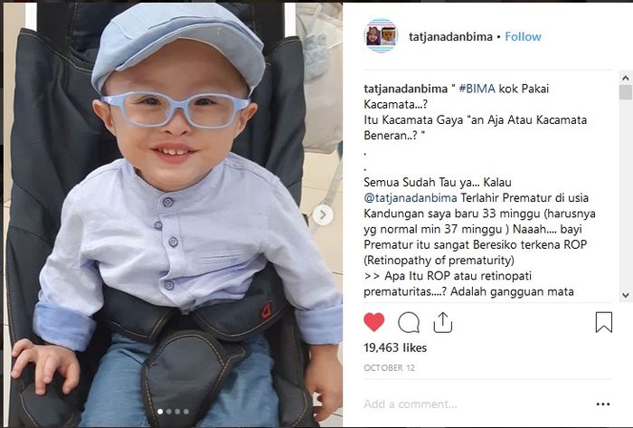 Bima pakai kacamata karena mengalami ROP