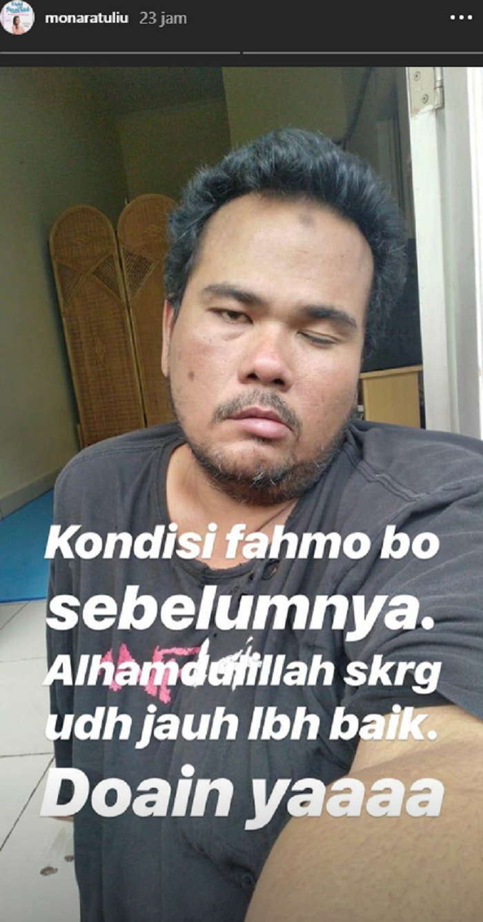 Kondisi Fahmi Bo saat terserang stroke
