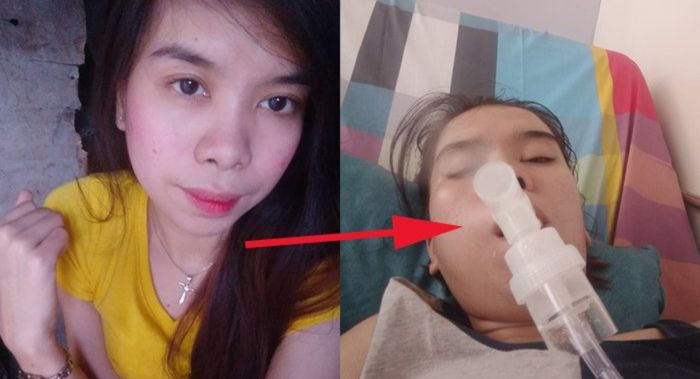 Mhary Mundoc Idanan terserang stroke akibat kecanduan bermain game Mobile Legends
