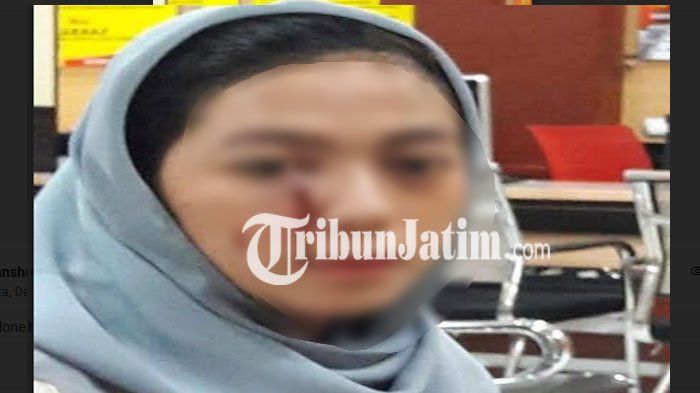 Korban Kasus Penganiayaan Saddil Ramdani, Anugrah Sekar Rukmi