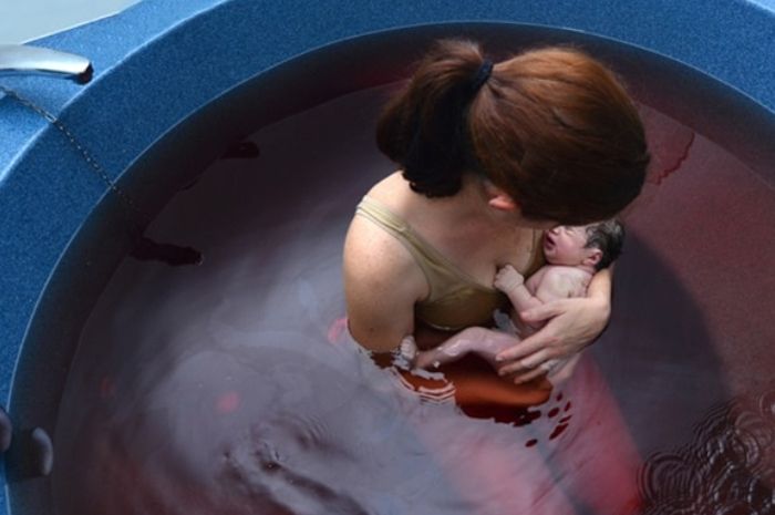 Water Birth