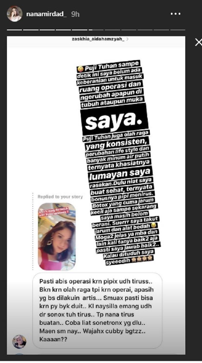 Nana Mirdad dituduh lakukan operasi plastik