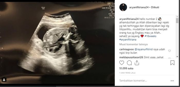 Potret hasil USG kehamilan Aryani Fitriana.